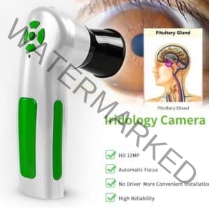 12 Mp Eye - Hair - Skin Analyzer - THE NEWEST & BEST ! .  *Price is *including worldwide FAST DHL shipping ! AT ALIEXPRESS 1375 $ * At ISHA only 995,00
